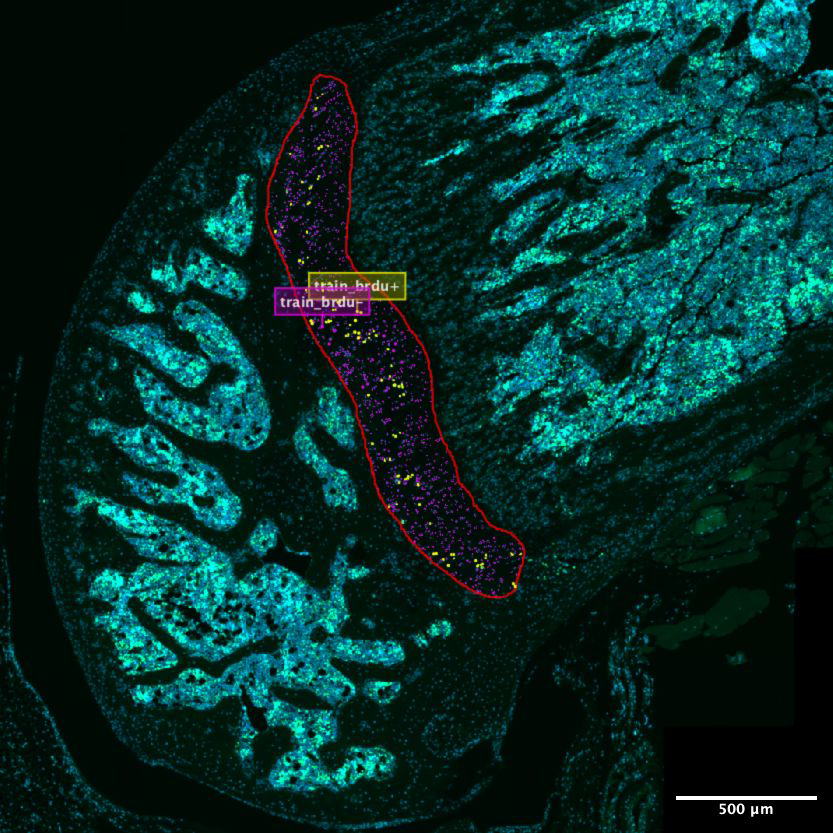 Multiplexed immunofluorescence — tumor microenvironment