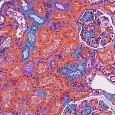 H&E section with renal tubules annotated and typed