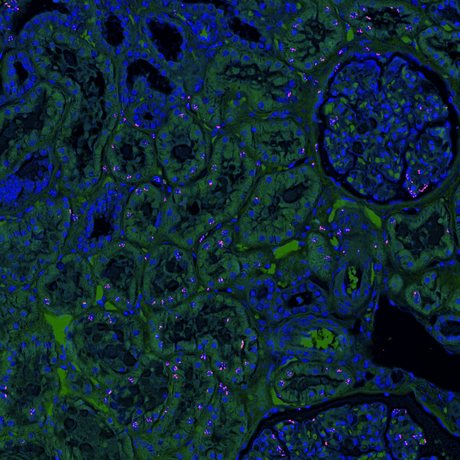 Adjacent serial section rendered as pseudo-fluorescence with simulated vector-genome puncta